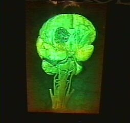 Holograma cérebro humano